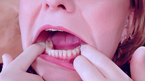 sounds tooth fetish lesbian kiss